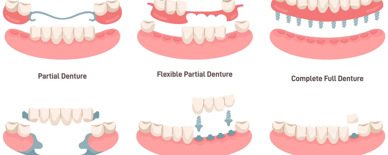 Dentures Bloomington, IL