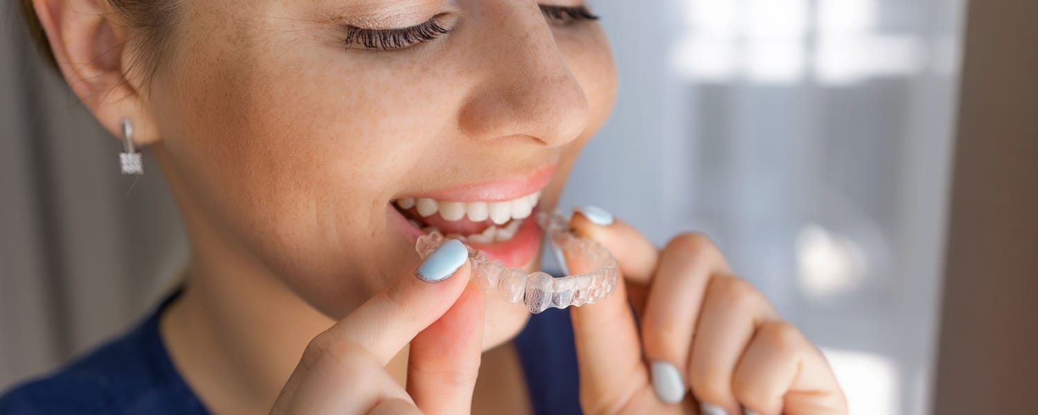 Invisalign 1 Invisalign in Bloomington, IL