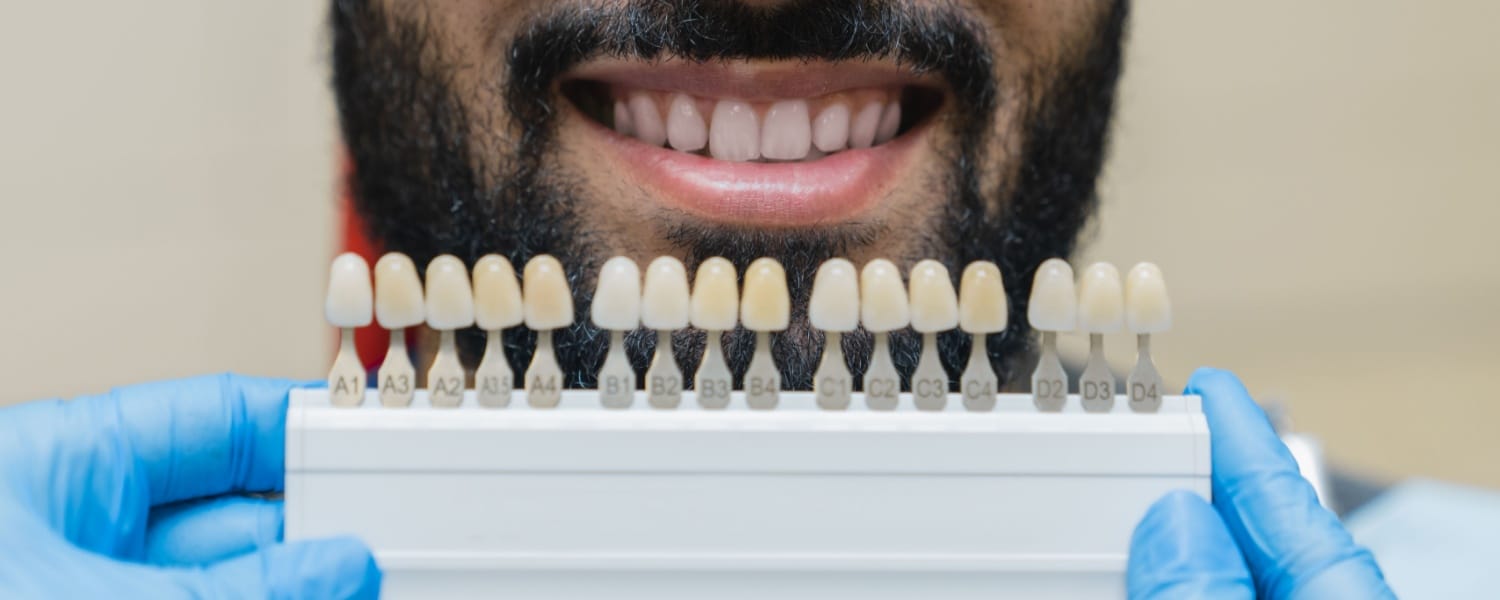 Tooth-Colored Fillings in Bloomington, IL