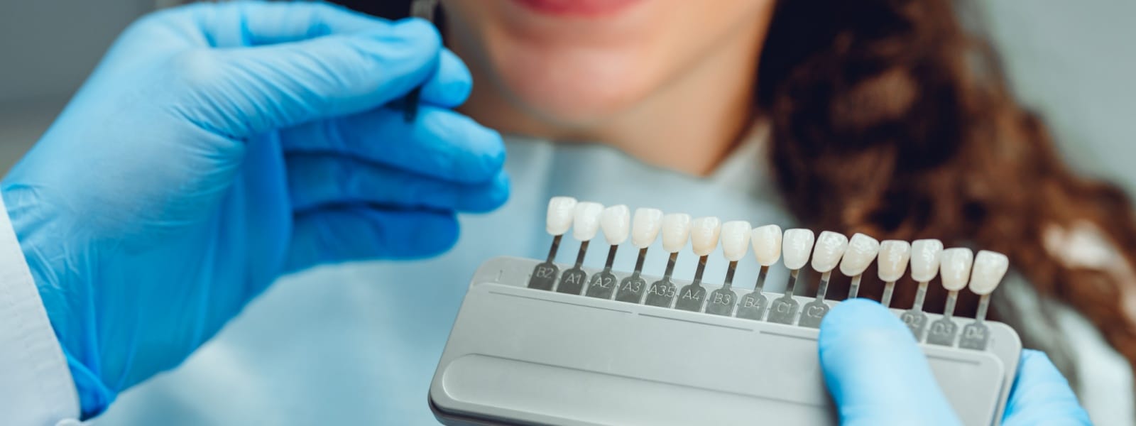 Tooth-Colored Fillings in Normal, IL: Invisible Repairs